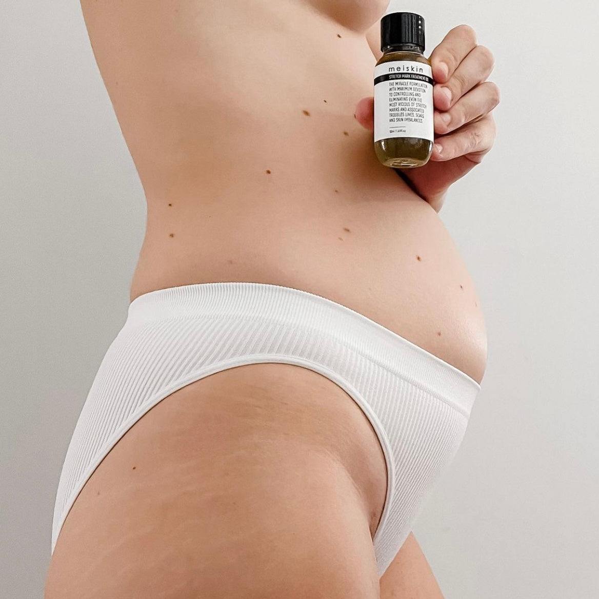 Mother applying Meiskin oil to postpartum belly