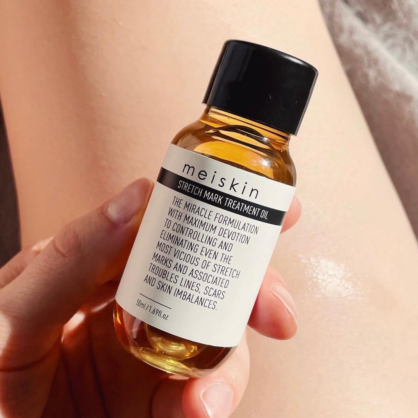 Postpartum woman using Meiskin Stretch Mark Treatment Oil for pregnancy stretch marks, scar healing, and natural skin restoration.